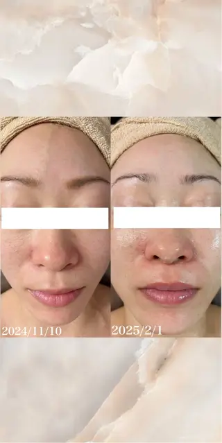 WHITE AQUA 北千住店のエステ・リラクイメージ