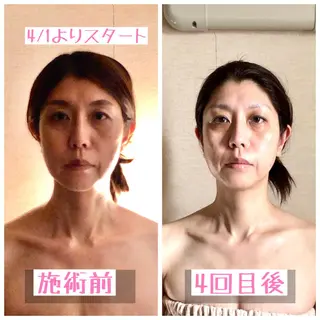小顔&ヘッドスパ haruhandのエステ・リラクイメージ