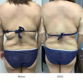 冷却専門店 SLARIのエステ・リラクイメージ