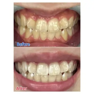 MBEAUTYSALON 千葉店・京成大久保所属・Melty 輝のその他イメージ