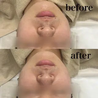 フェイシャルサロン CHIARA 荒田のエステ・リラクイメージ