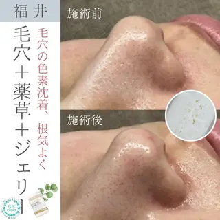 毛穴ケア専門サロン Yourmeユアミーのエステ・リラクイメージ