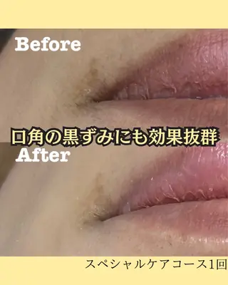 政時 鈴奈のエステ・リラクイメージ