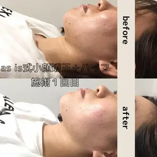 小顔専門アズイズ ビューティー　草津店のエステ・リラクイメージ