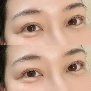 マツエク・マツパ Achura つばきのネイルデザイン