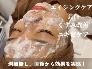 HINANO矢場町店【ヒナノ】所属・脱毛/肌改善🌿 HINANO 村田のエステ・リラクイメージ