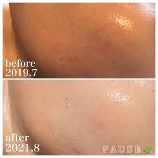 浜野 恵美のエステ・リラクイメージ