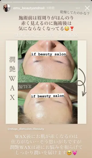 痩身・フェイシャル/if byOrabriller所属・if byOrab riller【イフ】のその他イメージ