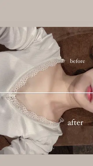 美容鍼灸サロン LOMIHARIのエステ・リラクイメージ