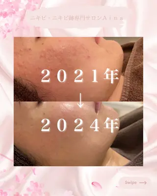 ニキビ跡専門サロン Ａｉｎａのエステ・リラクイメージ