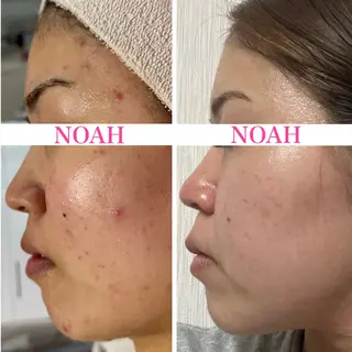 NOAH 小顔毛穴　川越店所属・NOAH ORIEのエステ・リラクイメージ