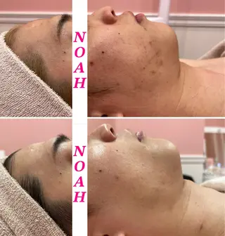 NOAH 小顔毛穴 川越店所属・NOAH ORIEのエステ・リラクイメージ