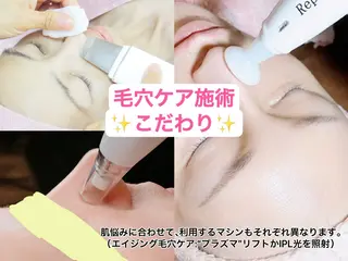 エレガンテ　ビューティーサロン所属・🎀エレガンテ🎀 美肌専門👸本間のその他イメージ