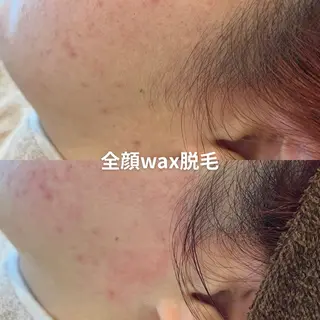 EST BEAUTY所属・顔専門ワックス脱毛/ ハーブピーリングのエステ・リラクイメージ