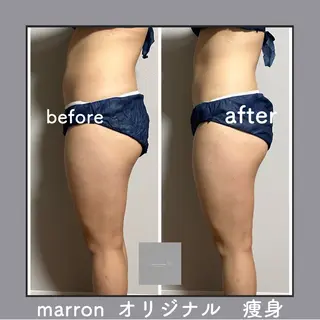 marron所属・痩身ハイパーナイフ ララピールリアボーテのエステ・リラクイメージ