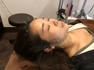 メンズ 美容鍼灸サロン LOMIHARIのエステ・リラクイメージ