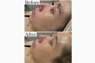 脱毛&フェイシャル 専門店muro.のエステ・リラクイメージ