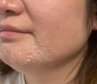 Auguspa〜オーガスパ〜所属・つるんとむき卵肌に 🌟ハーブピーリングのエステ・リラクイメージ