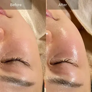 Mandarin Orange所属・毛穴から始める肌メン テマンダリンオレンジのエステ・リラクイメージ