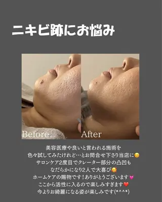 BLOSSOM 菊地のエステ・リラクイメージ