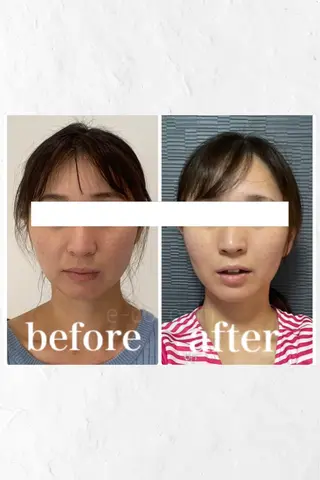 小顔と ヘッドスパのお店のエステ・リラクイメージ