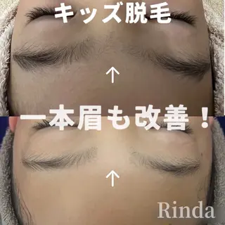 ブライダル痩身×脱毛 尼崎駅前サロンのエステ・リラクイメージ