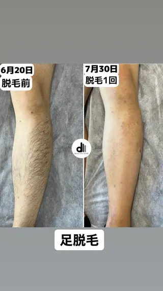 メンズ Beauty Salon MARU所属・新潟市メンズ【脱毛】 MARUのエステ・リラクイメージ