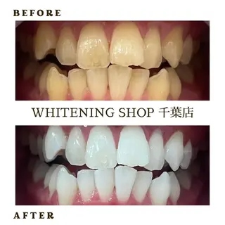 メンズ ホワイトニング ショップ千葉店のその他イメージ