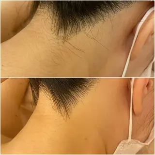 ✨美肌水光✨ アトリエリュバンのエステ・リラクイメージ