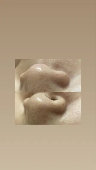 磐田｜LAYLA 一番丁寧な脱毛店のエステ・リラクイメージ