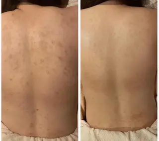 for woman所属・森 美優のエステ・リラクイメージ