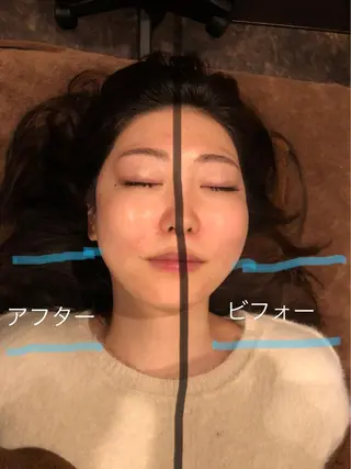 美容鍼灸サロン LOMIHARIのエステ・リラクイメージ