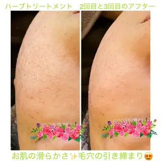 オーガニック＆ホロソフィー　エステサロンGARDEN所属・GARDEN 田辺加代子のエステ・リラクイメージ