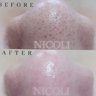 エステサロン NICOLIのエステ・リラクイメージ