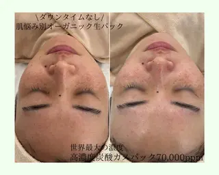 〈etre〉トータルビューティーサロン所属・etre - 韓国肌管理 -のエステ・リラクイメージ