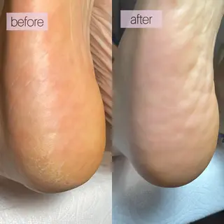 ネイル Rainbow nailsくろちゃんのネイルデザイン