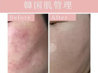 Luana武蔵小杉店 (ルアナ)のエステ・リラクイメージ