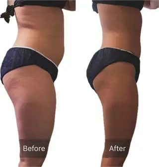 本気で痩せたい方へ 痩身専門サロンのその他イメージ