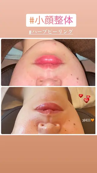 FLEUR大阪・整体 ・ハイフ・痩身・小顔のエステ・リラクイメージ