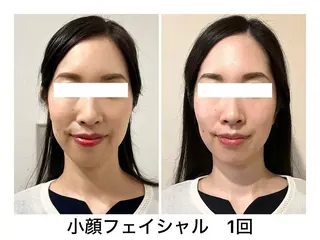 エステサロンNarcis〜ナルシス〜所属・脱毛&痩身エステ Narcisのエステ・リラクイメージ