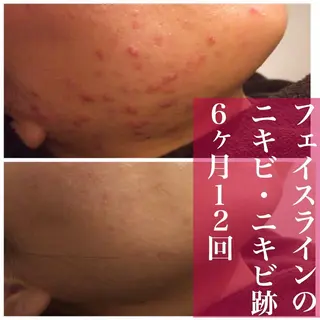 憧れの韓流すっぴん肌 🤎肌管理専門エステのエステ・リラクイメージ