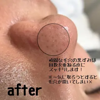 L’oeillet所属・🌊🌊__ juna__のマツエク・マツパデザイン