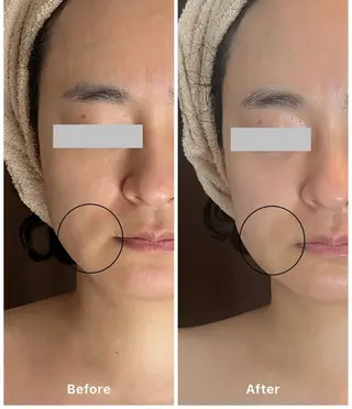 エステサロン Libertaのその他イメージ