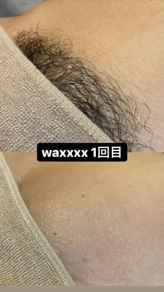 Epina 千葉店 【エピナ】のエステ・リラクイメージ