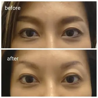 Mecal RYOKOのその他イメージ