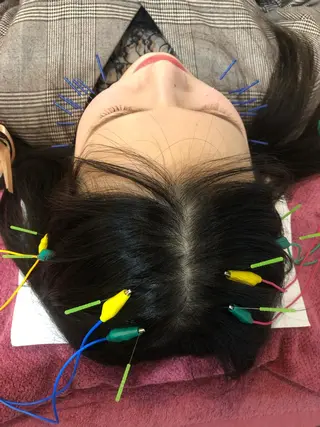 美容鍼灸女性専用 りんご鍼灸治療院のその他イメージ