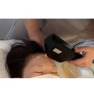 インディバ術後 痩身🔥 ヨコヤマのエステ・リラクイメージ