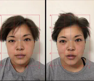 やはた鍼灸整骨院所属・やはた 鍼灸整骨院のエステ・リラクイメージ