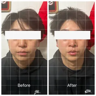 メンズ エマニエル USAのエステ・リラクイメージ