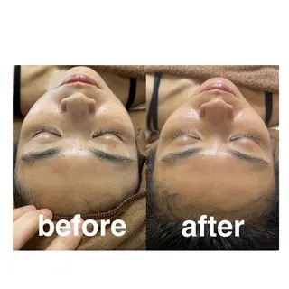 美容鍼灸サロン mahoroba院長のエステ・リラクイメージ